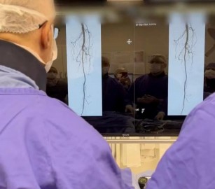 Hospital Divina realiza primeiro procedimento em Porto Alegre com dispositivo absorvível para artérias abaixo do joelho